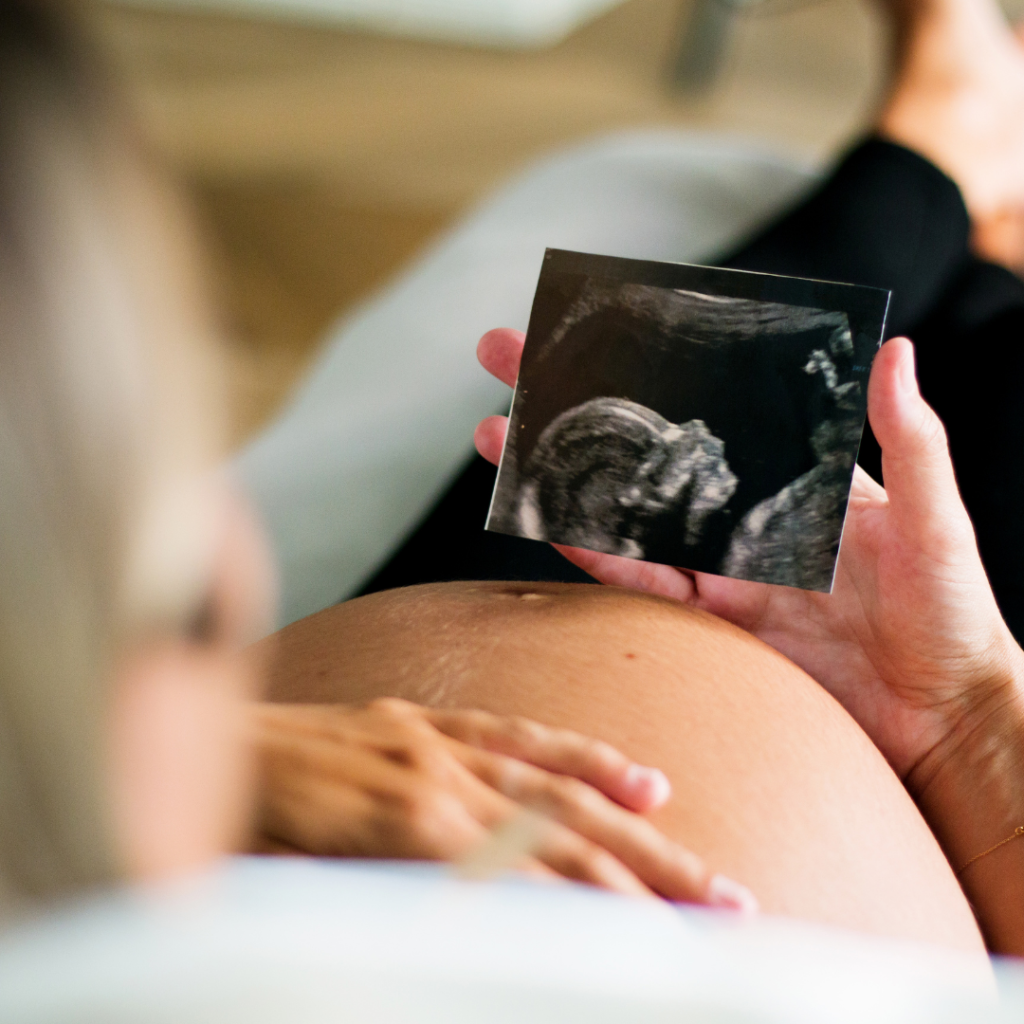 Woman nearing end of pregnancy looking at sonogram of fully developed baby